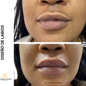 Labios-2