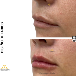 Labios-3