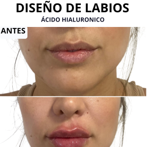 Labios-4