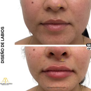 Labios-6